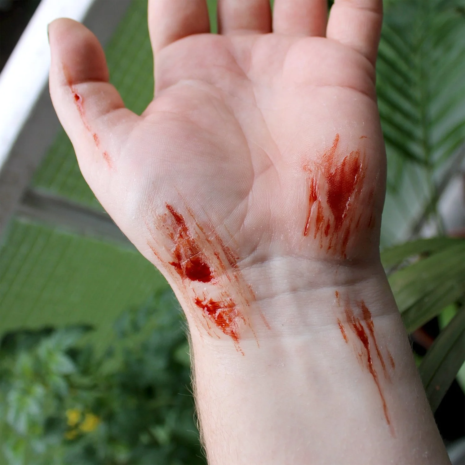 Thumbnail 2